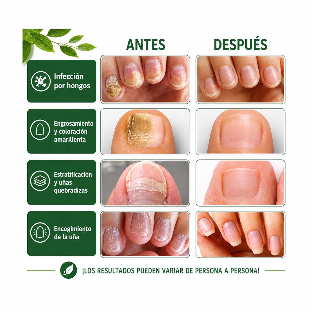 Balm Antifungal