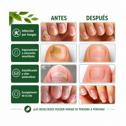 Balm Antifungal